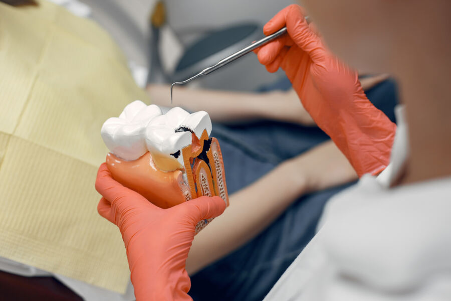 cavity