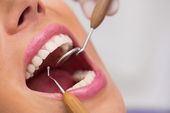 tooth decay treatment